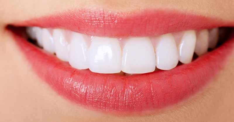 Dusver Dertig kasteel natuurlijk tanden bleken is de beste methode voor gezonde witte tanden